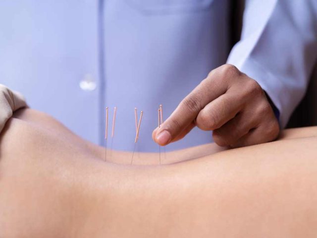 Real and Simulated Acupuncture Appear Effective for Back Pain