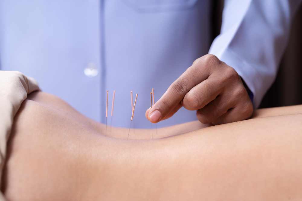Real and Simulated Acupuncture Appear Effective for Back Pain