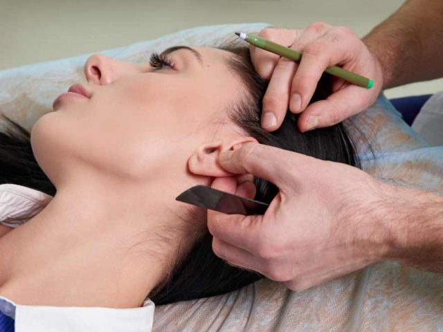 Acupuncture Provides True Pain Relief in Study