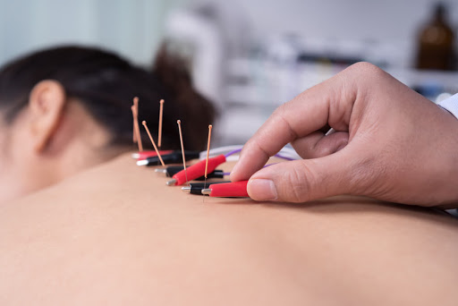 

Discover The Benefits Of Electro-Acupuncture 