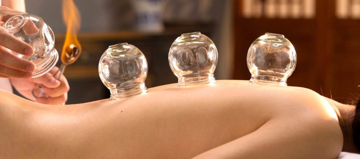 Cupping Therapy