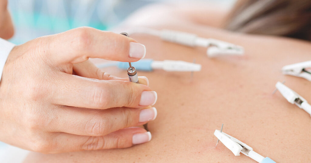 bluemoonacupuncture