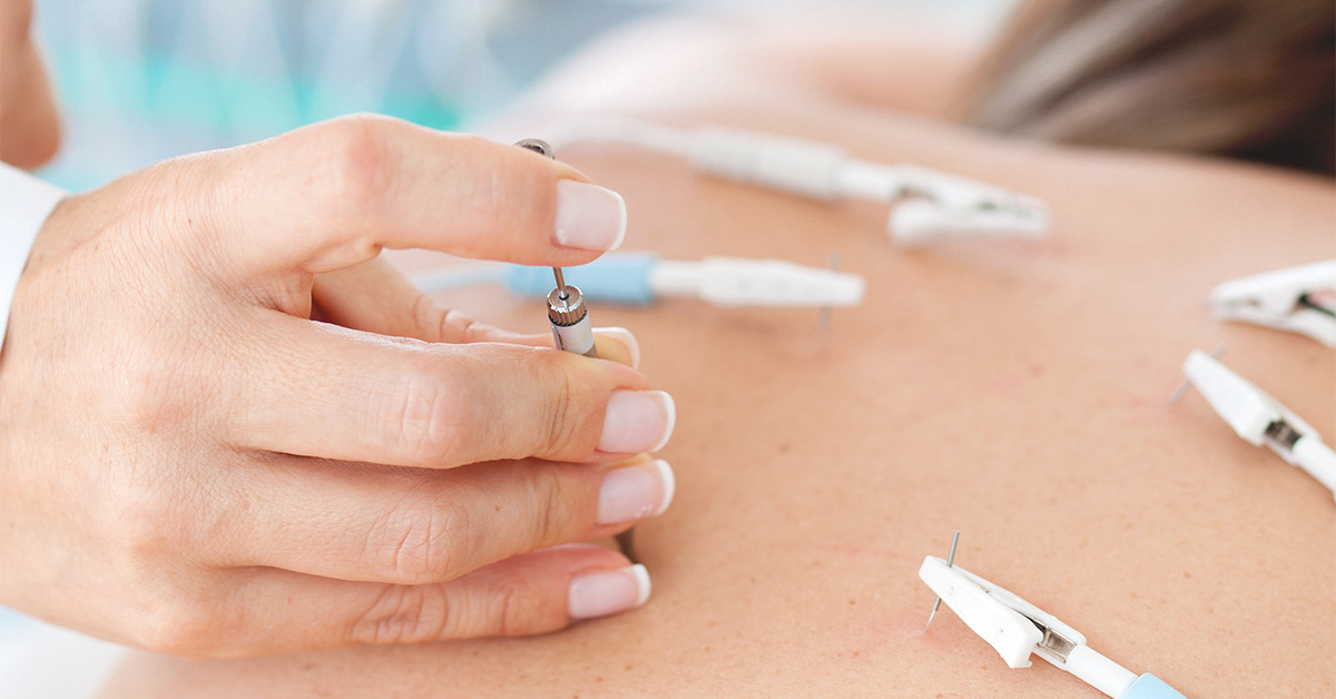 bluemoonacupuncture