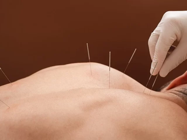 health-and-wellbeing-benefits-of-acupuncture