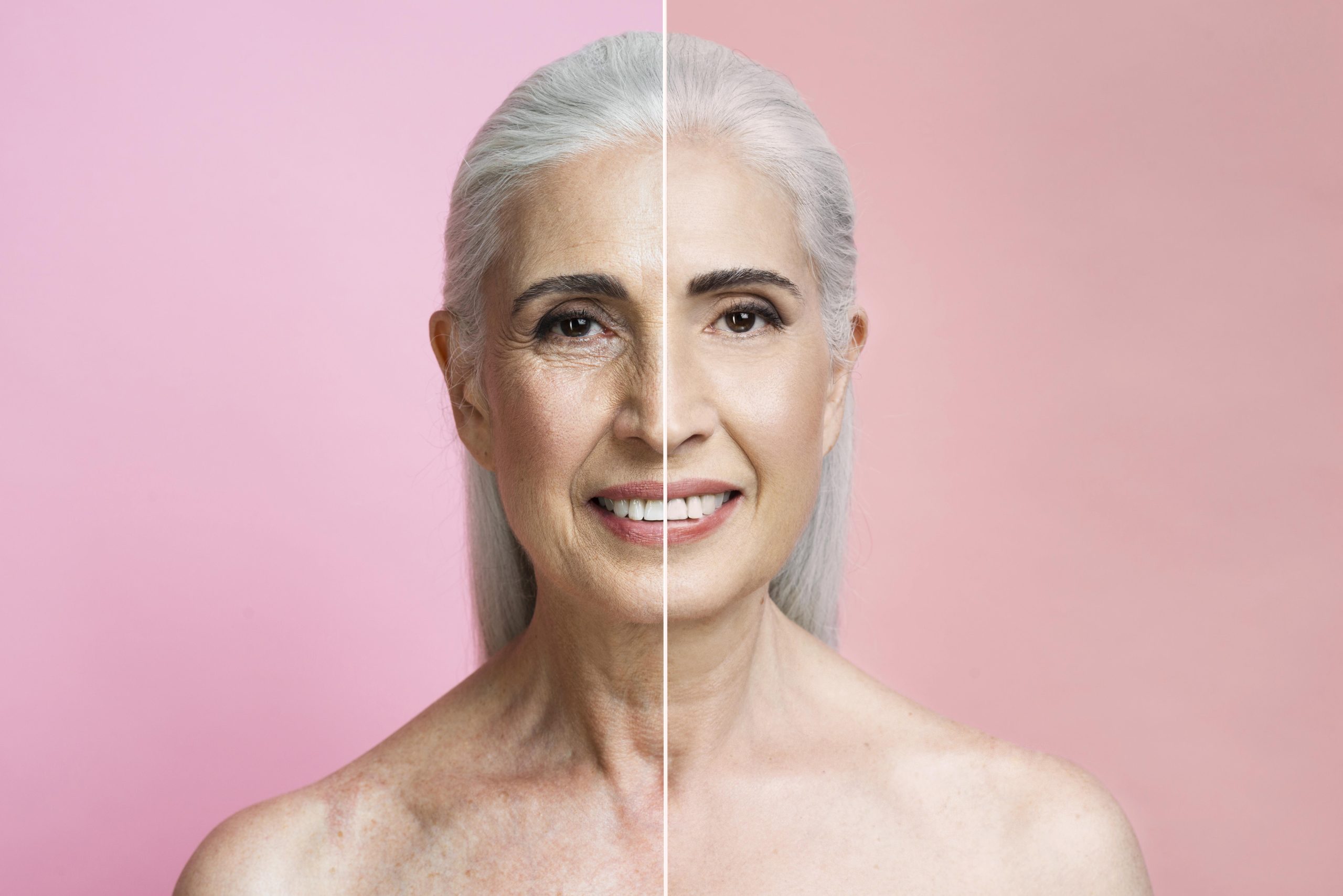 before-after
