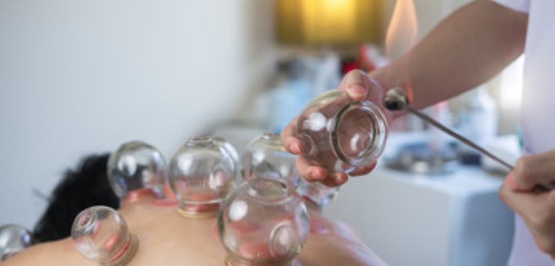 Cupping Therapy