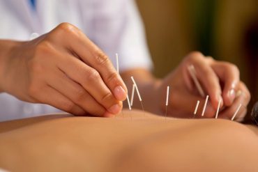 How Chronic Pain Treatment with Acupuncture Can Transform Your Life