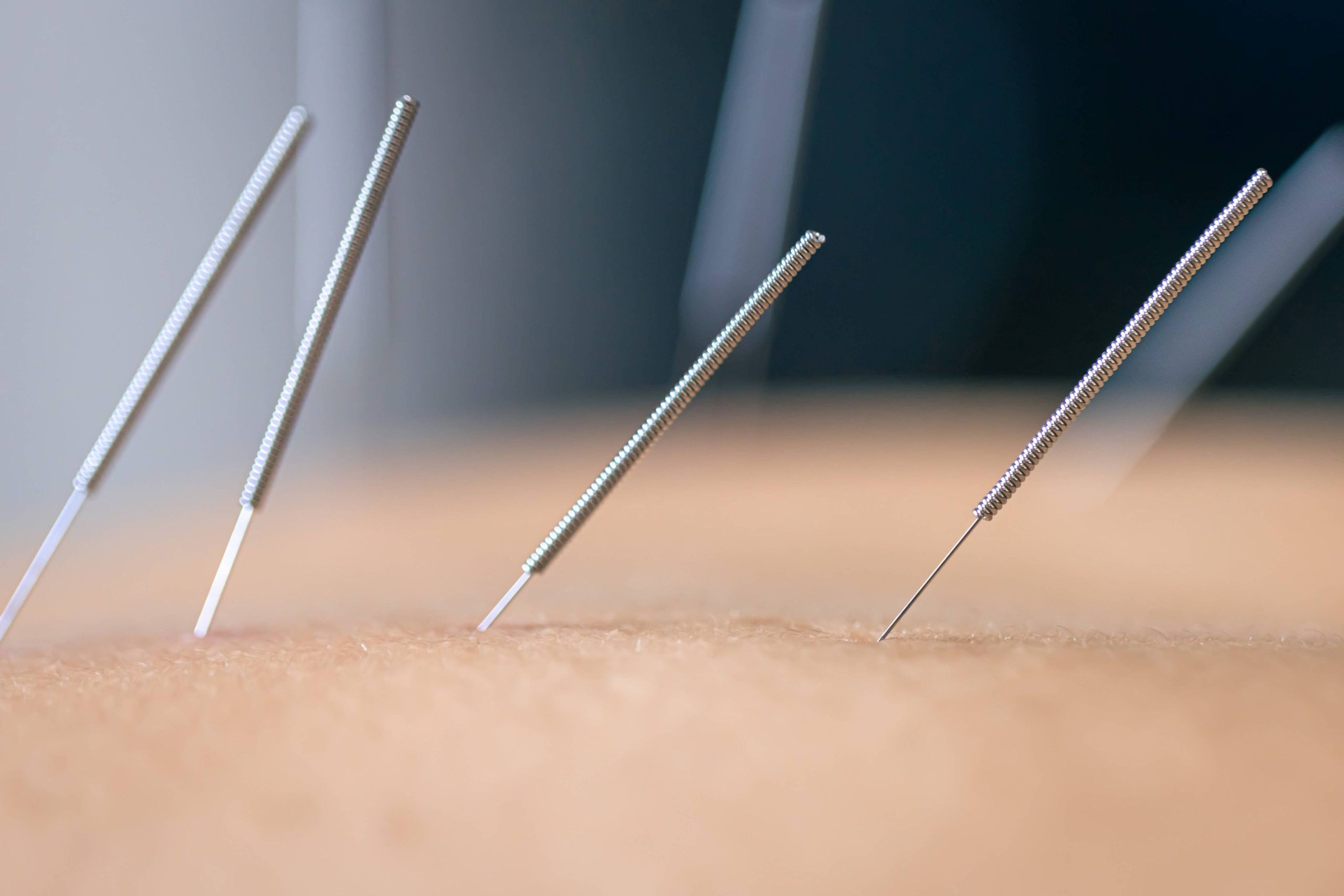 dry-needling