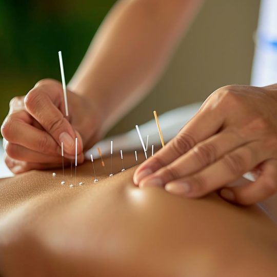 orthopedic acupuncture