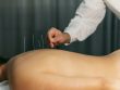 Pain Management Acupuncturists