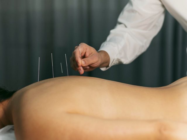 Pain Management Acupuncturists