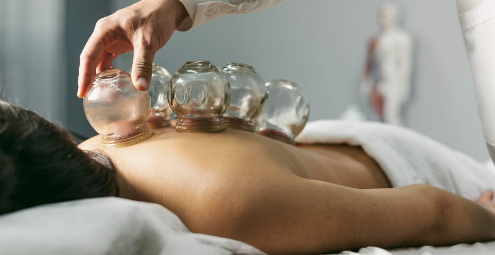 Cupping Therapy