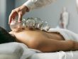 Cupping Therapy