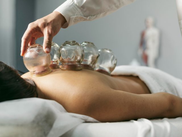 Cupping Therapy