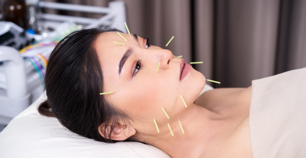 Cosmetic Acupuncture