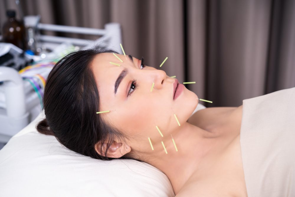 Cosmetic Acupuncture