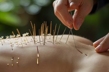 5 Powerful Ways Acupuncture Can Improve Life with Scoliosis