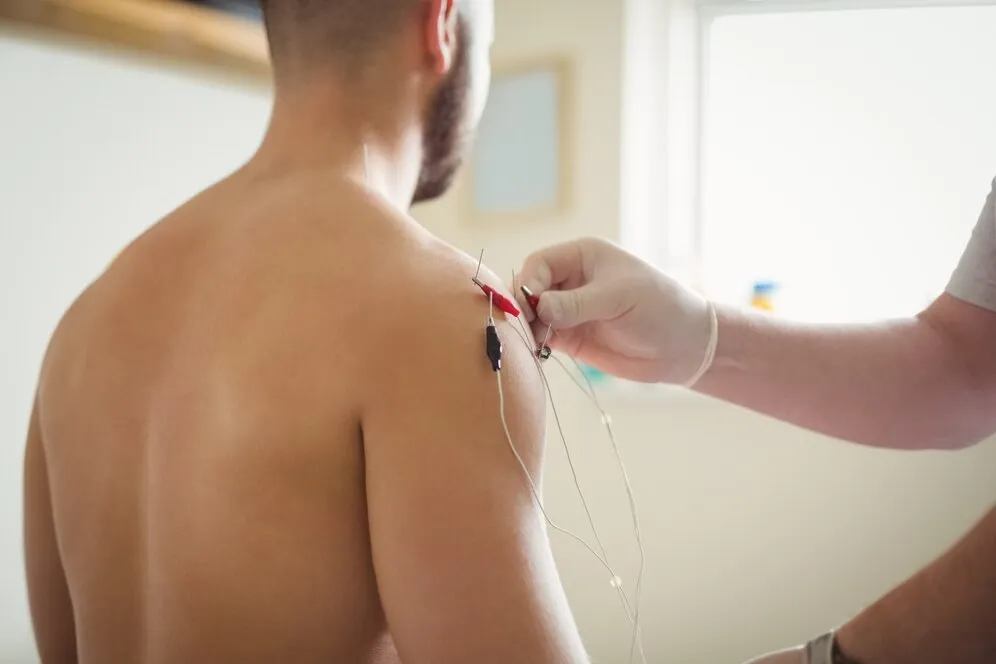 close-up-physiotherapist-inserting-needles-patient