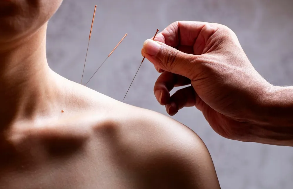 bluemoonacupuncture