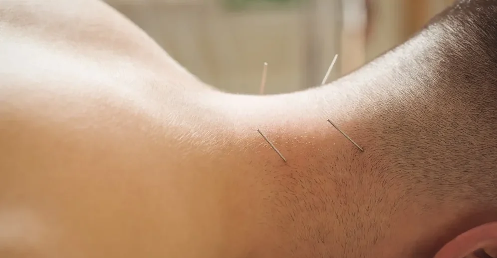 bluemoonacupuncture