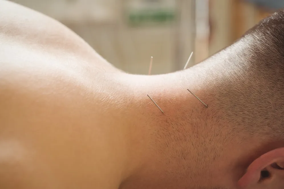 bluemoonacupuncture