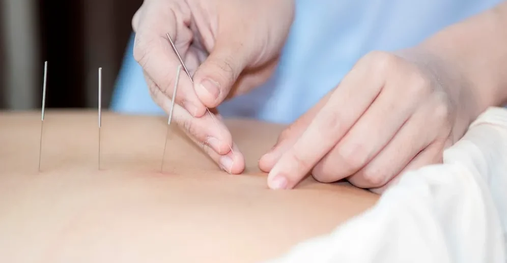 bluemoonacupuncture