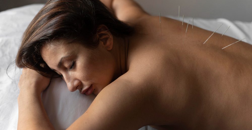 How Acupuncture Supports Sleep Naturally