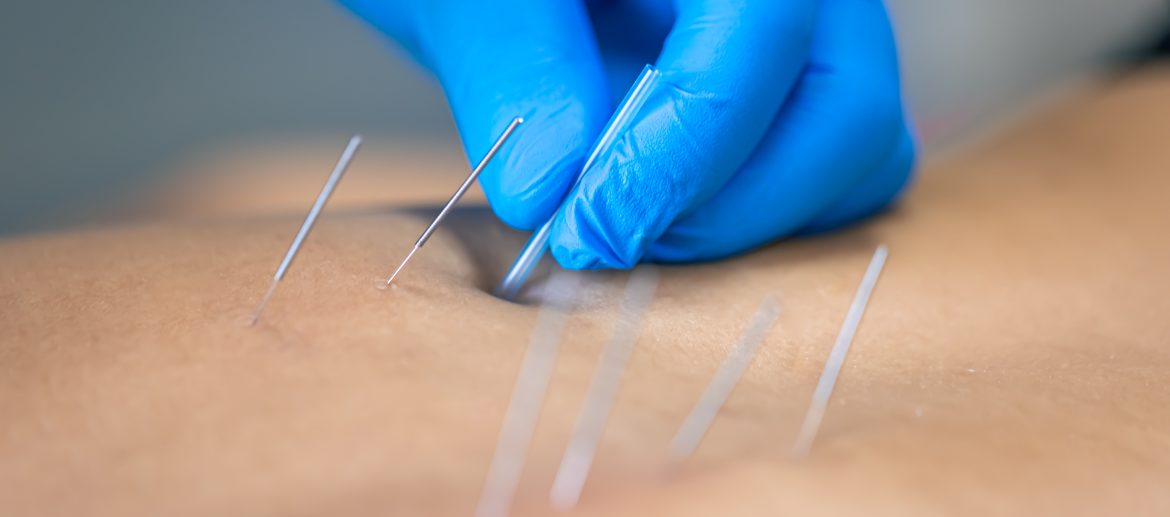 orthopedic acupuncture