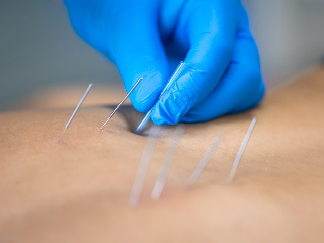 orthopedic acupuncture