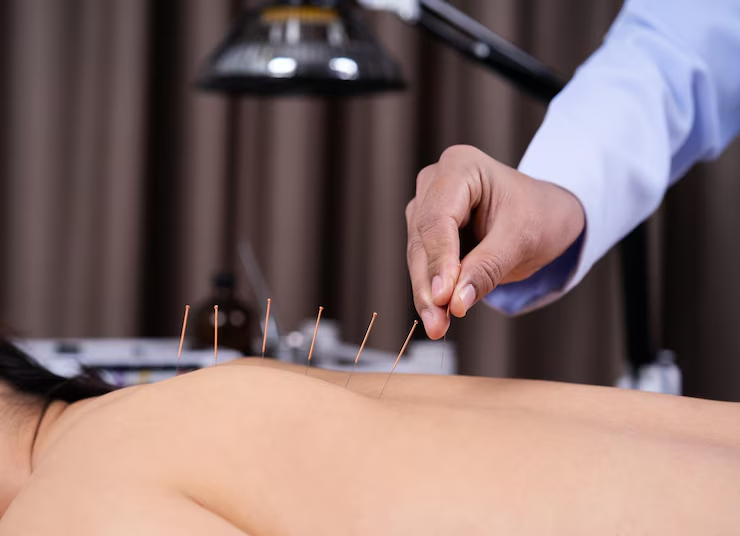 bluemoonacupuncture