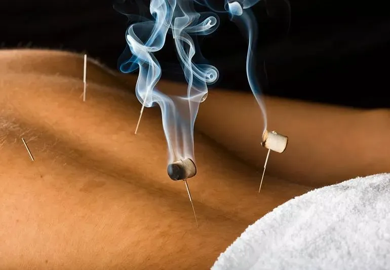 bluemoonacupuncture