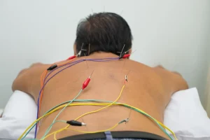 bluemoon accupuncture