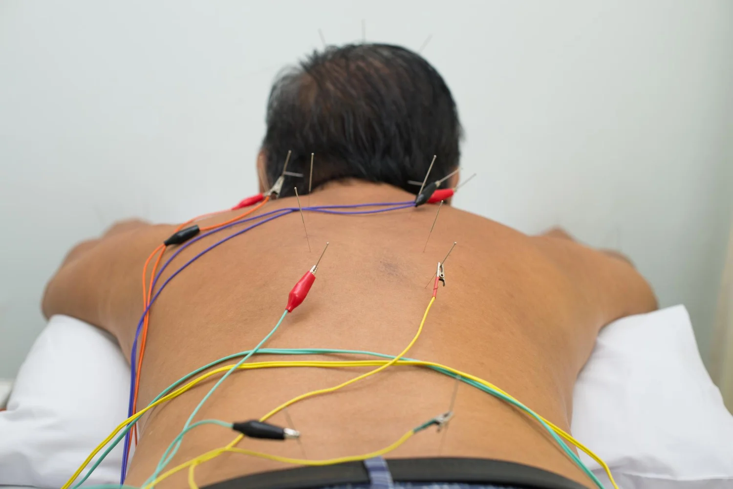 bluemoon accupuncture