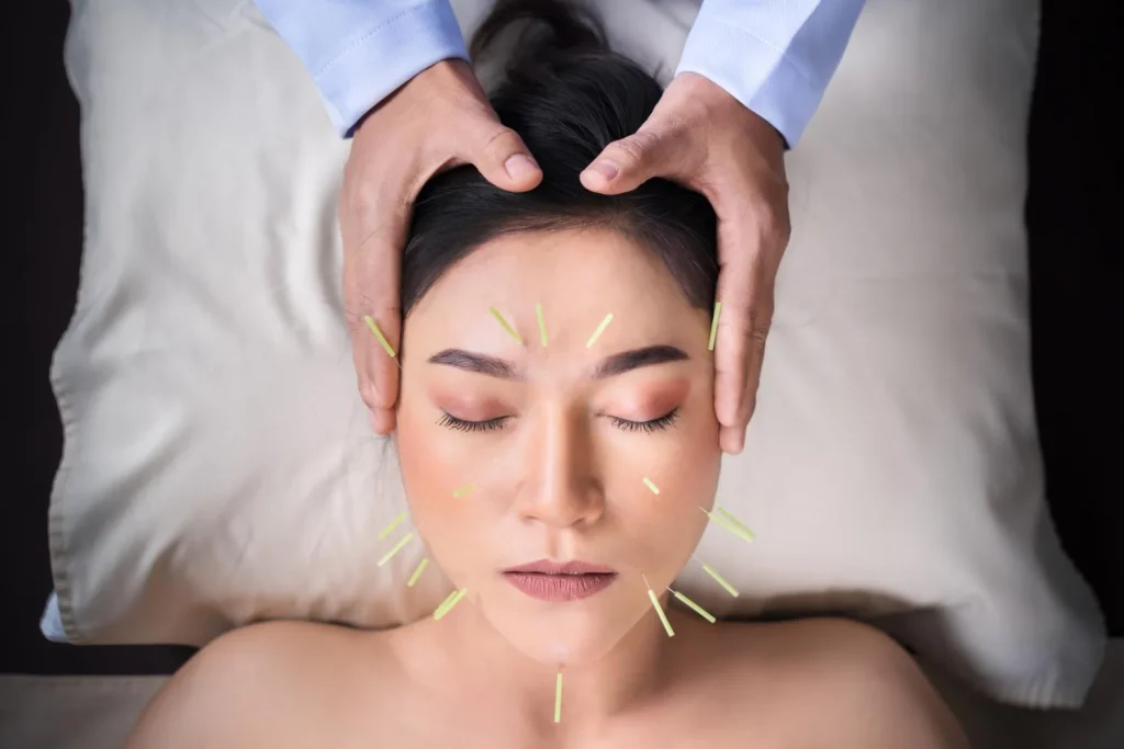 bluemoonacupuncture