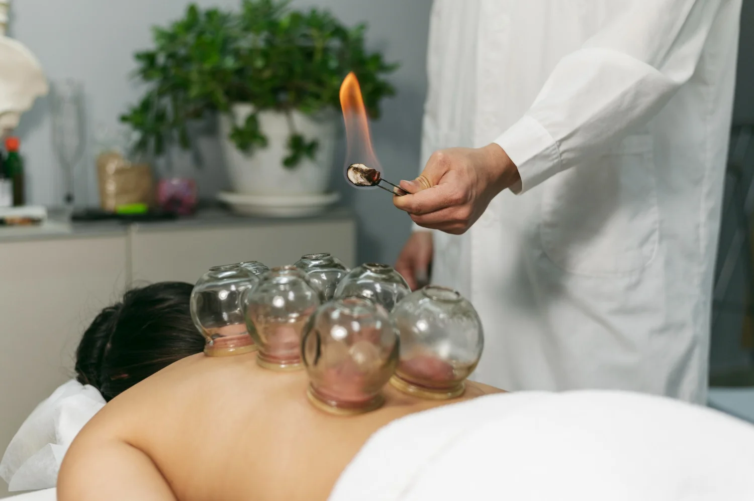 bluemoon accupuncture