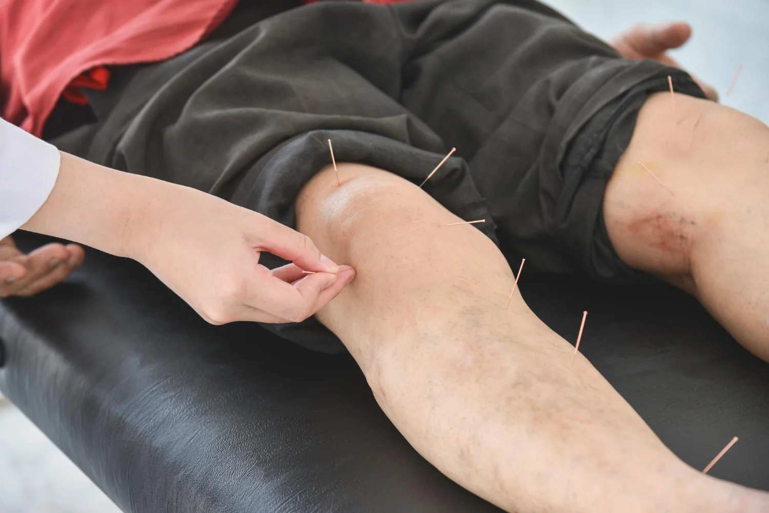bluemoon accupuncture