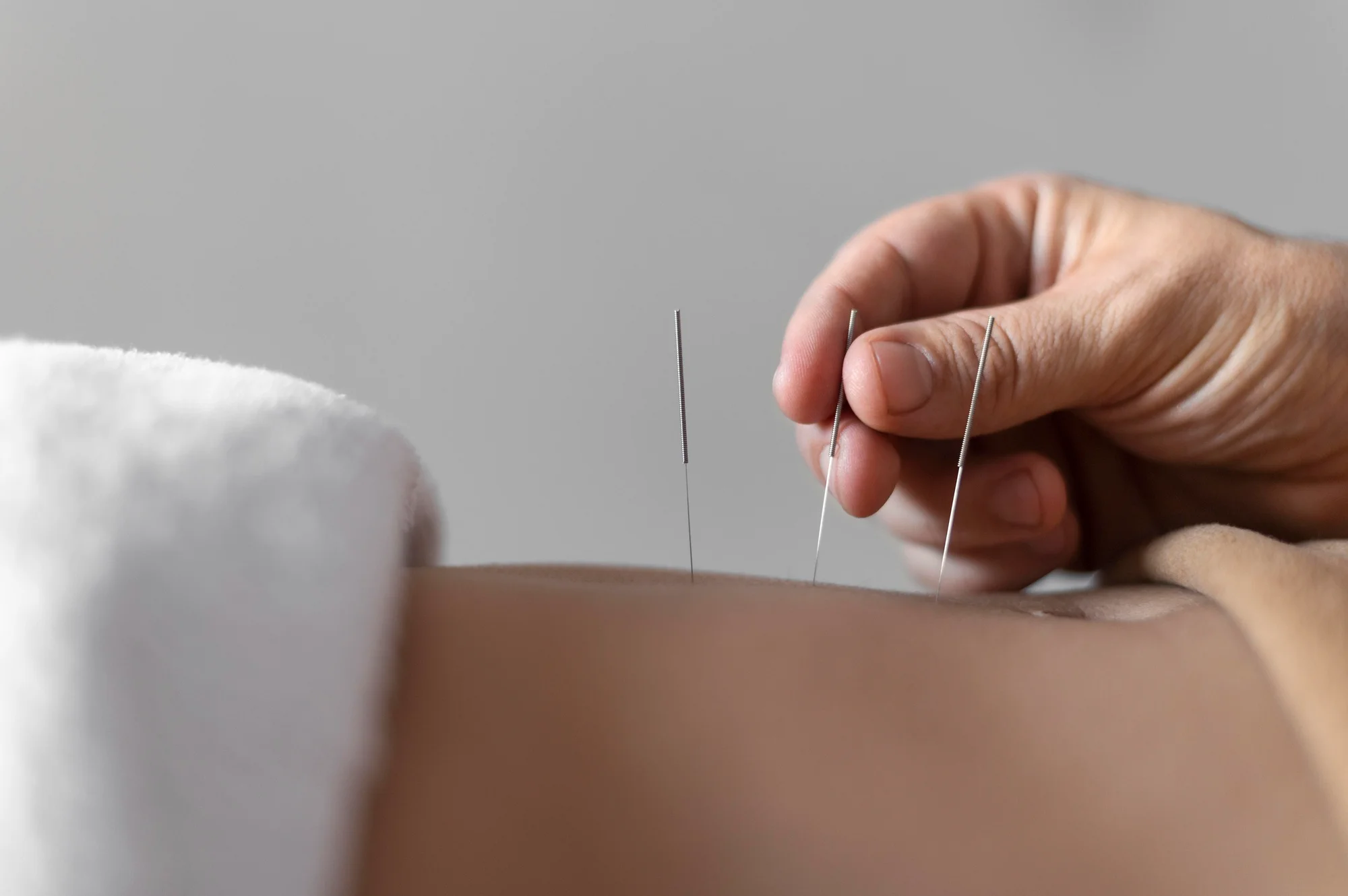 bluemoon accupuncture