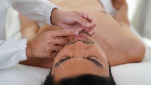 bluemoonacupuncture