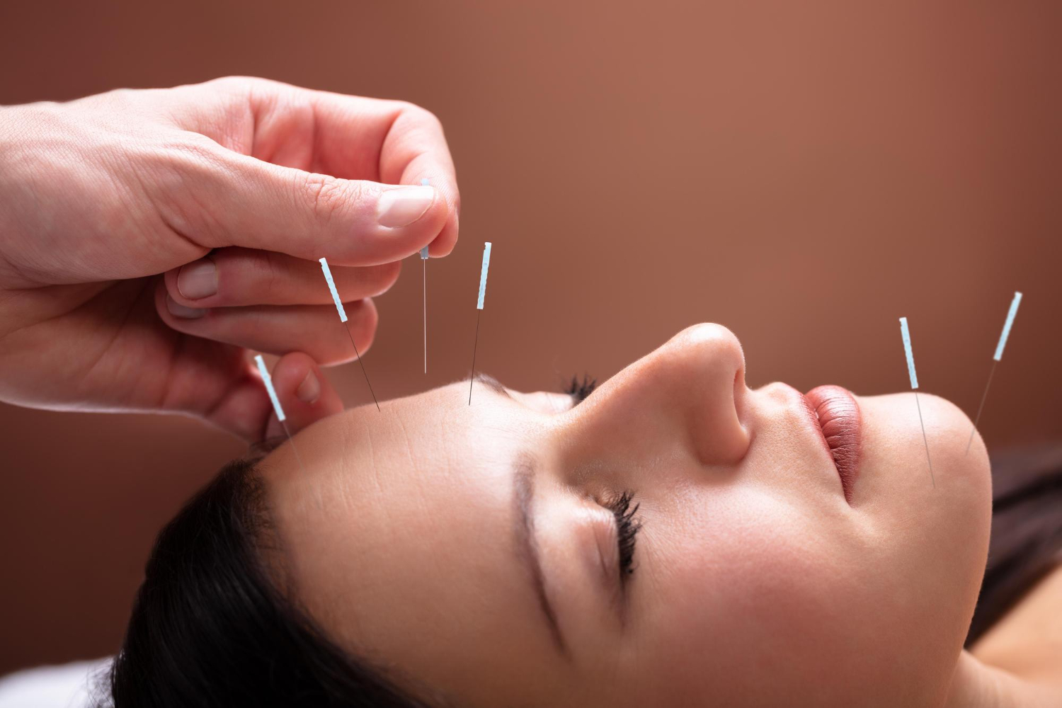 bluemoonacupuncture