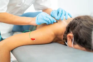 bluemoon accupuncture