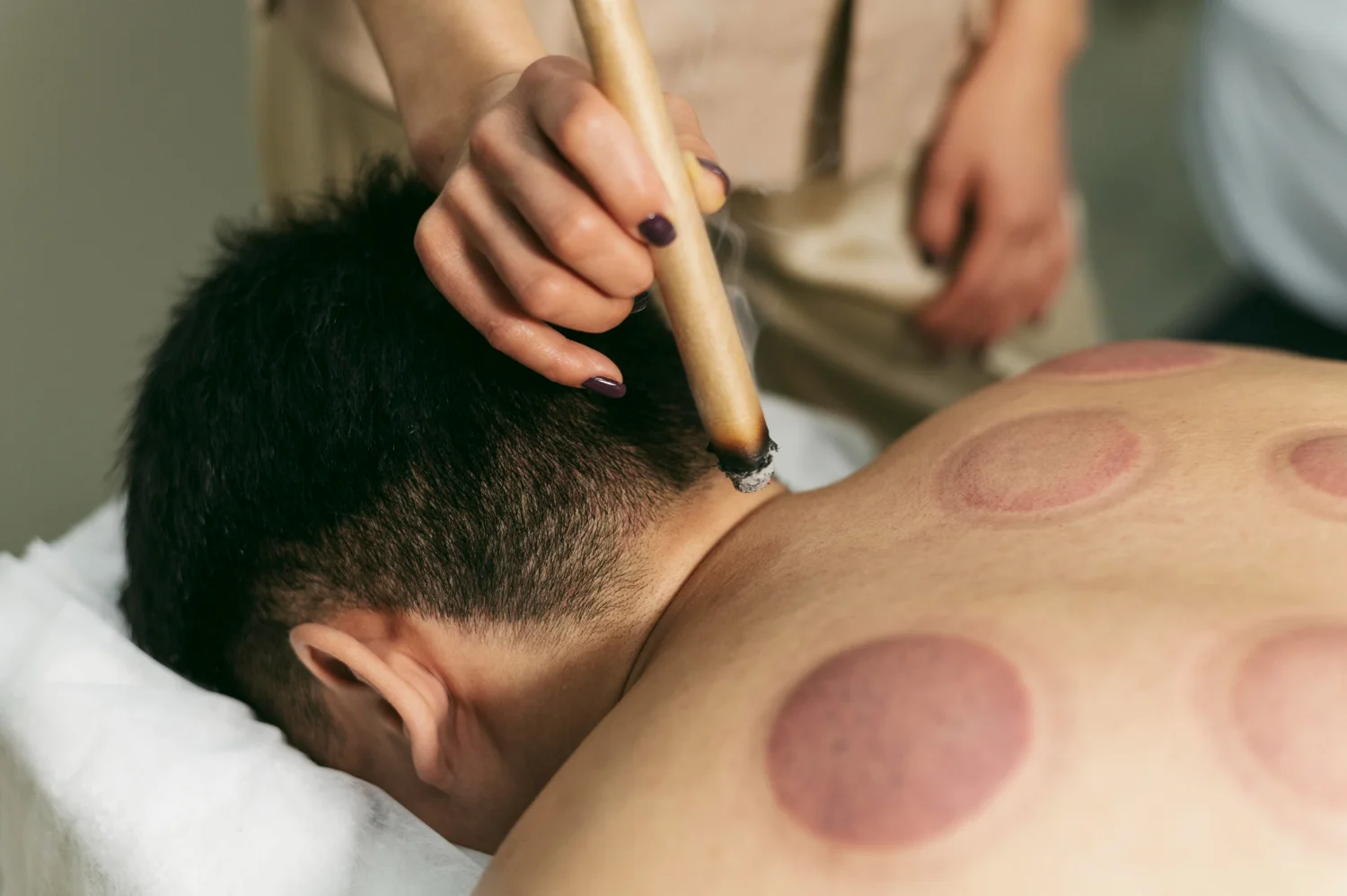bluemoon accupuncture