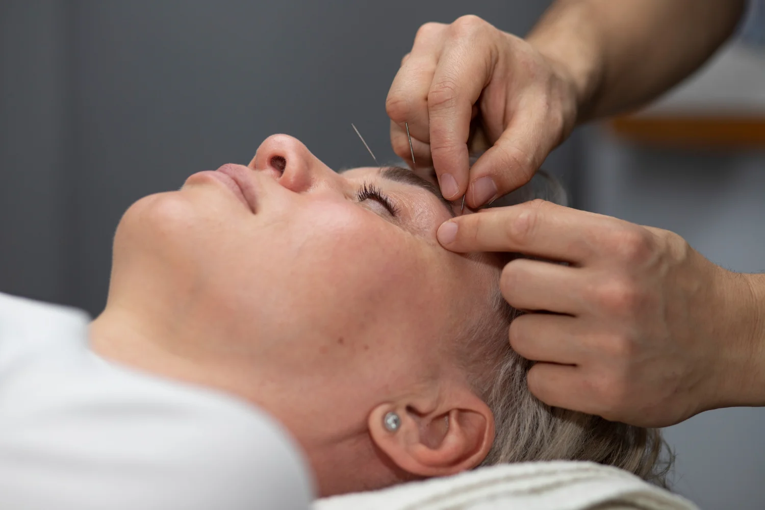 bluemoon accupuncture