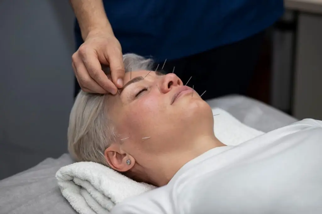 dry needling face